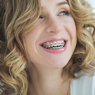 Exceptional-dental-care-359-Dental-Orthodontics-Services-Braces
