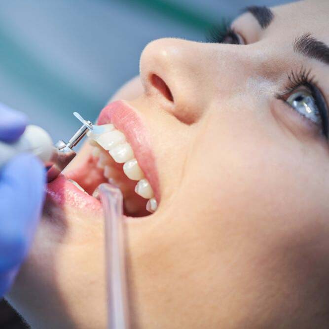 Exceptional-dental-care-359-Dental-Orthodontics-Services-Cleaning
