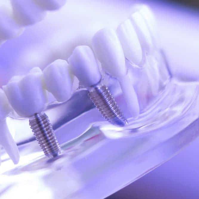 Exceptional-dental-care-359-Dental-Orthodontics-Services-Implants