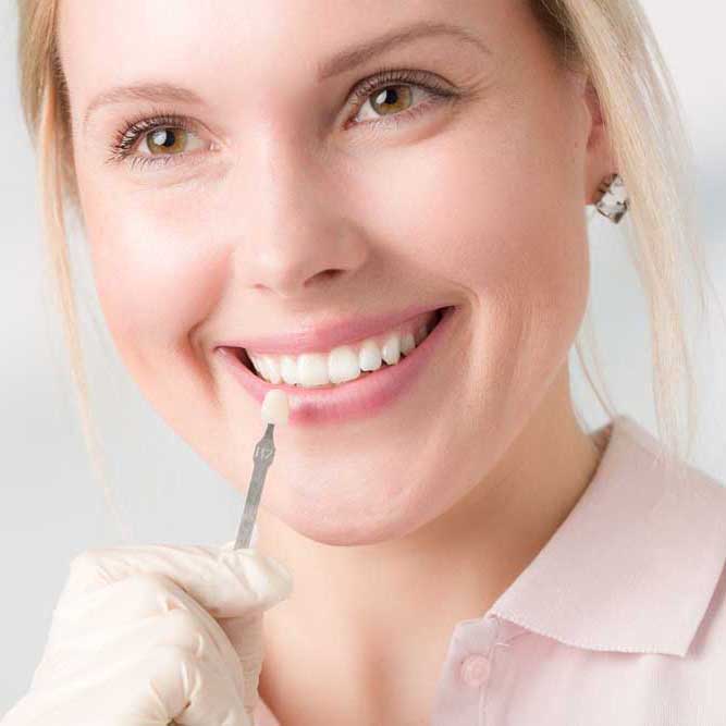 Exceptional-dental-care-359-Dental-Orthodontics-Services-Veneers-
